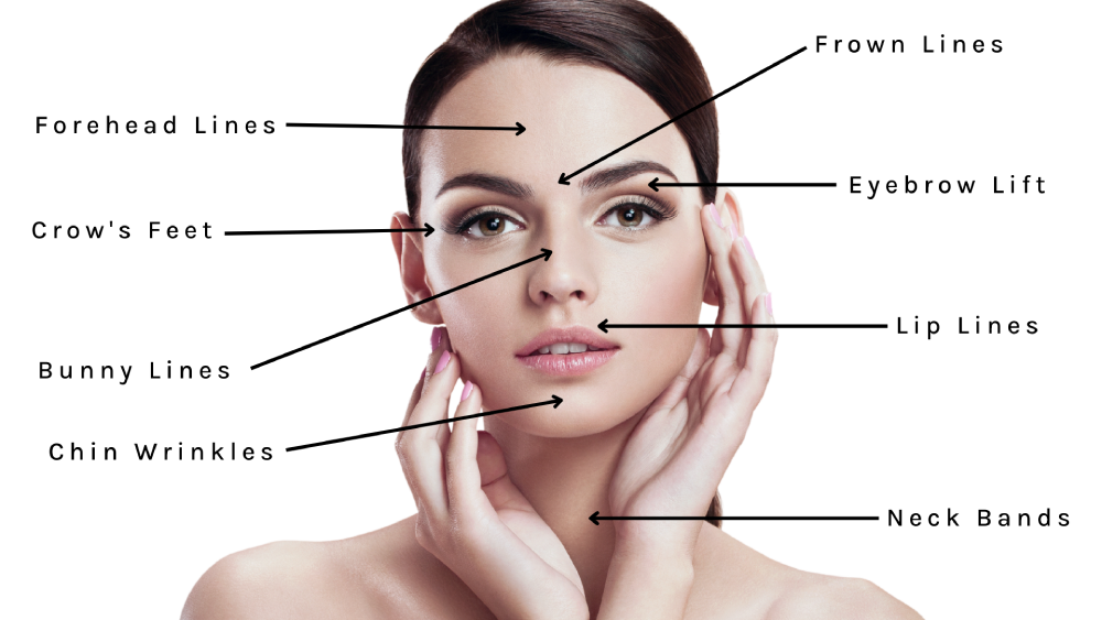 Botox Treatment Areas on Young Women's Face | Kor Medspa in Wyomissing, PA