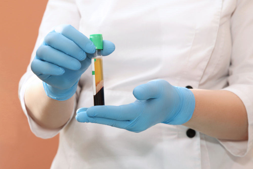 Medical Professional Holding Blood Test-tube | Kor Medspa in Wyomissing, PA