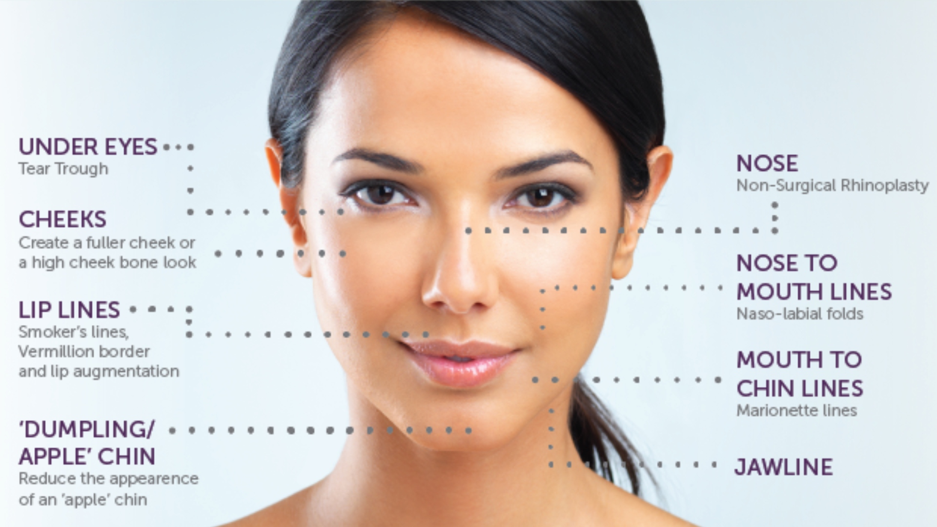 Facial Fillers Treatment Areas on Young Women's Face | Kor Medspa in Wyomissing, PA